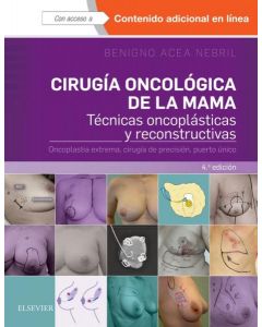 Cirugia oncologica de la mama