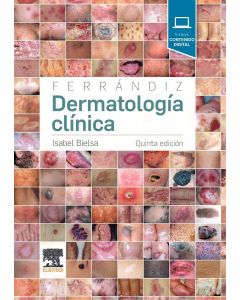 Ferrandiz. dermatologia clinica (5ª ed.)