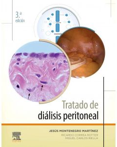 Tratado de dialisis peritoneal