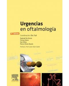 Urgencias en oftalmologia