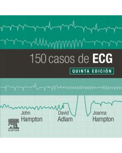 150 casos de ecg