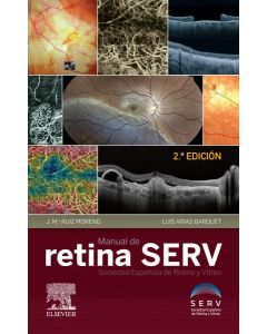 Manual de la retina serv