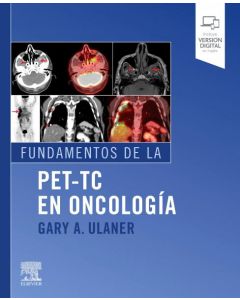 Fundamentos de la pet-tc en oncologia