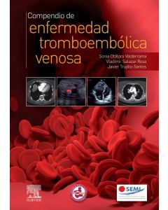 Compendio de enfermedad tromboembolica veanosa